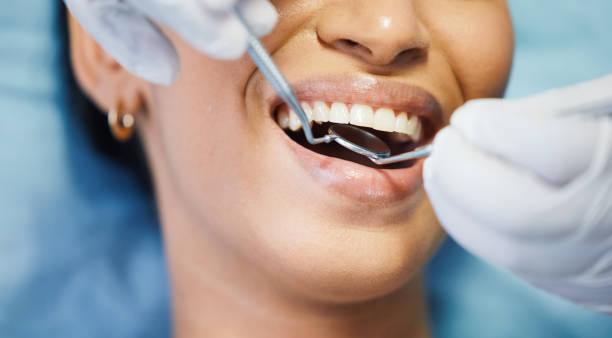 Best Emergency Dentist for Knocked-Out Tooth in Clarendon, TX