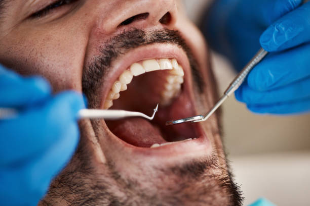 Best Emergency Dental Extractions in Clarendon, TX